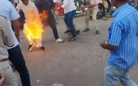 पुतला जलाते-जलाते अपना पायजामा जला बैठे कांग्रेस नेता