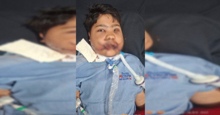 ब्लास्ट में टूटी चेहरे की 100 हड्डियां, जोड़कर बच्चे को दी नई जिंदगी,डॉक्टरों ने कर दिया कमाल…